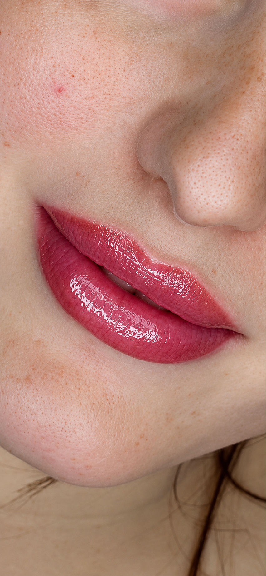 Full lips labbra — dopo